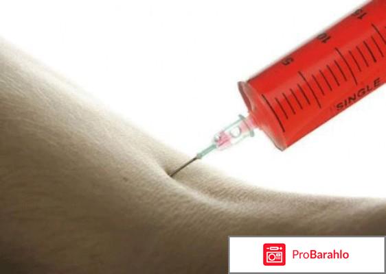 Мильгамма уколы отзывы врачей отрицательные отзывы