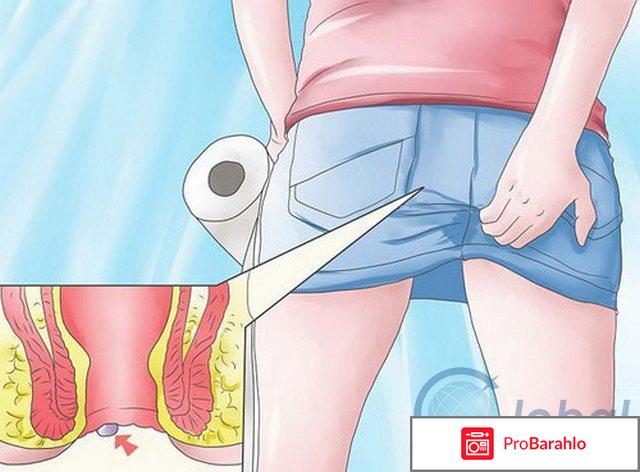 Прокто-Гливенол отрицательные отзывы