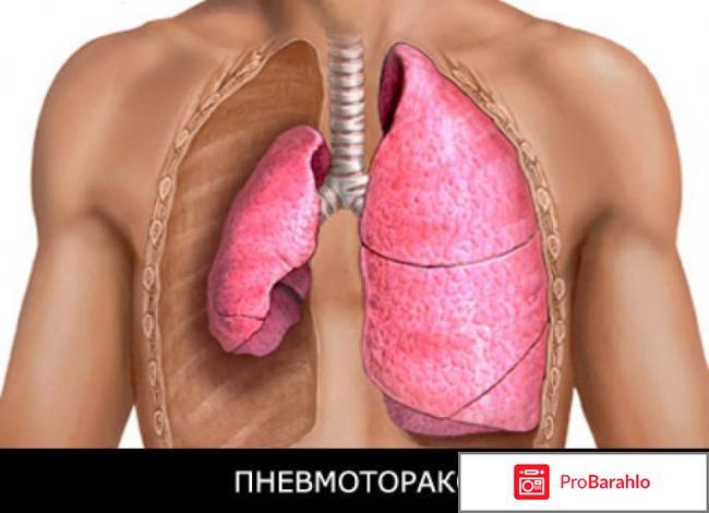 Виталий казакевич отзывы отрицательные 