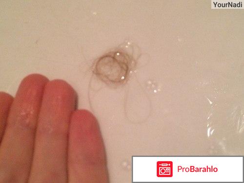 Шампунь алерана для роста отзывы обман