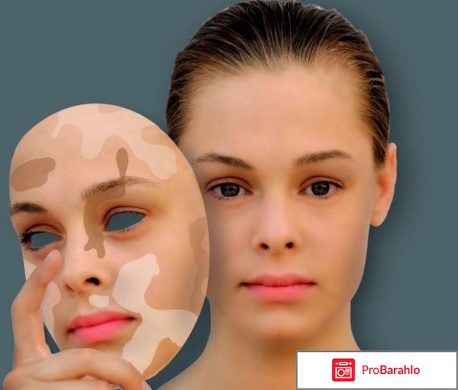 Витилиго лечение 2017 лекарство отзывы обман