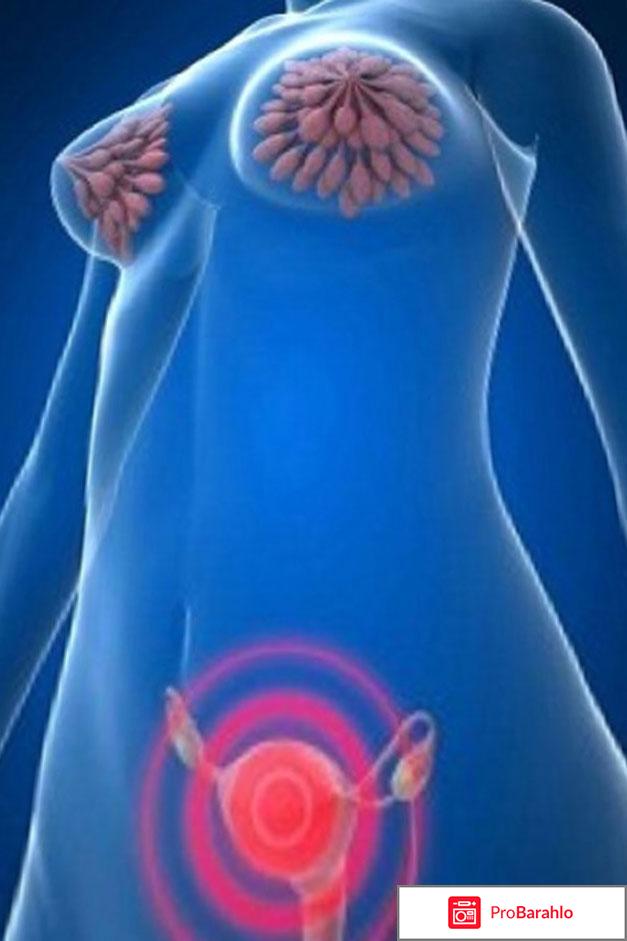 Пролактин симптомы 