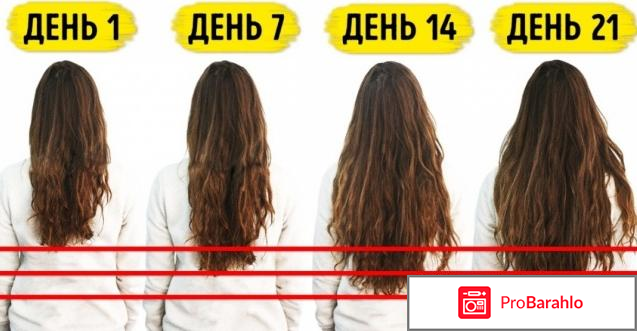 Миноксидил отзывы женщин форум 