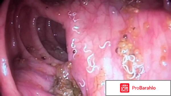 Gelmifort (Гельмифорт) 