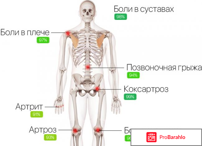 Artrovex отзывы владельцев