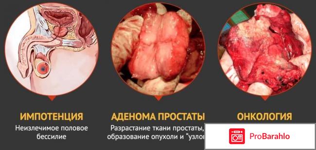 Простолайф очередной развод или правда реальные отзывы