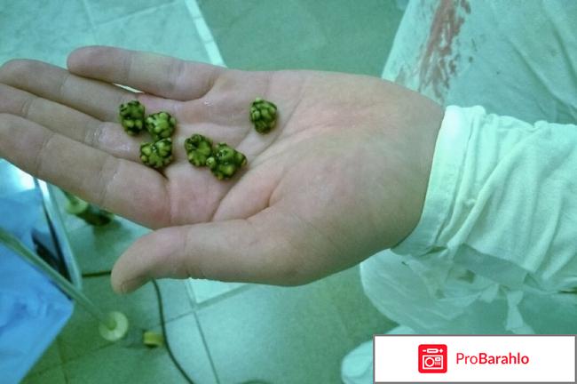 Ливодекса инструкция по применению цена отзывы 