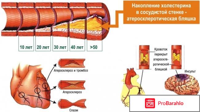 Дуплексное сканирование сосудов головы и шеи: цена 