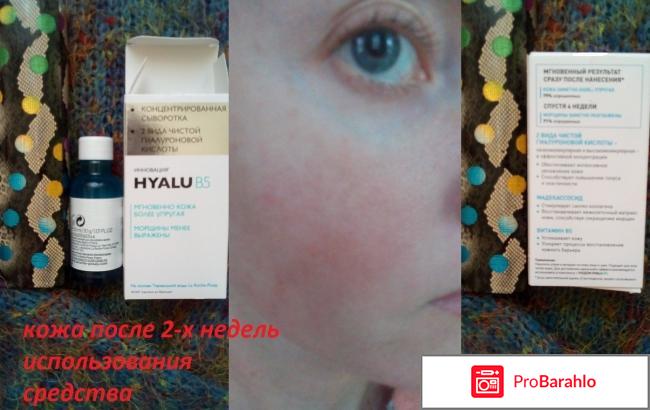 HYALU B5 концентрированная сыворотка с гиалуроновой кислотой отзывы владельцев