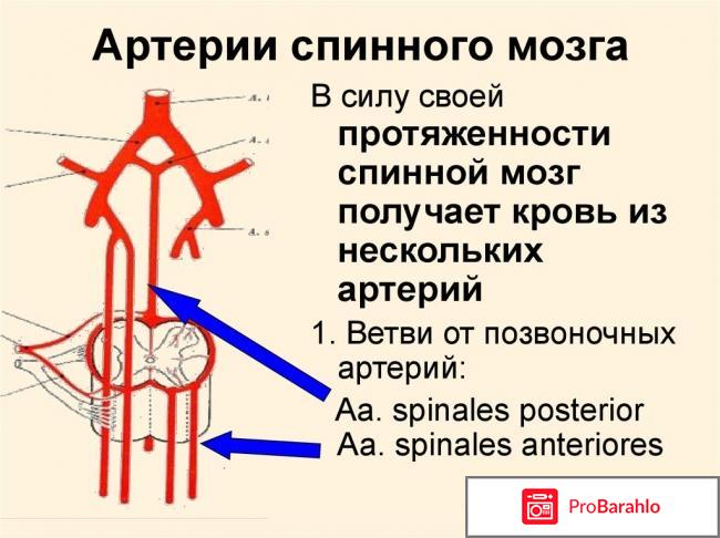 Гипоплазия позвоночной артерии 