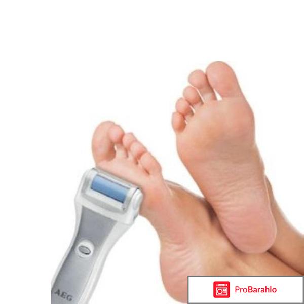 AEG PHE 5642 отрицательные отзывы