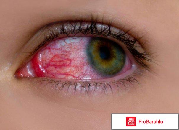 Бетоптик глазные капли инструкция цена отзывы обман