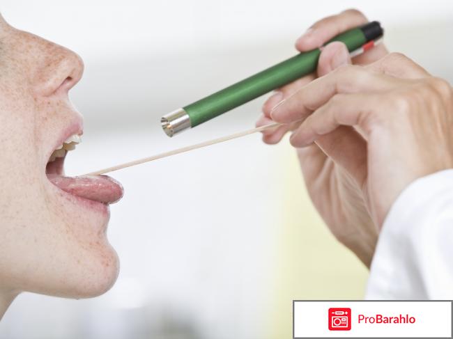 Фарингит отрицательные отзывы