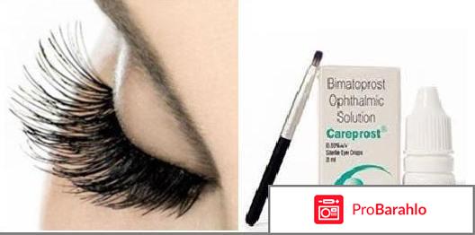 Карепрост цена отрицательные отзывы