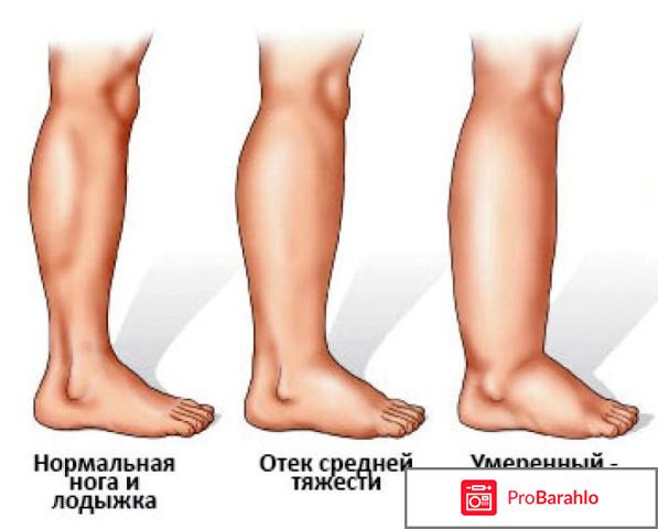 Аппарат надежда отзывы покупателей обман