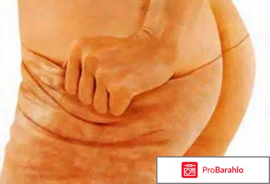 Пластырь для похудения soso slimming plaster отрицательные отзывы
