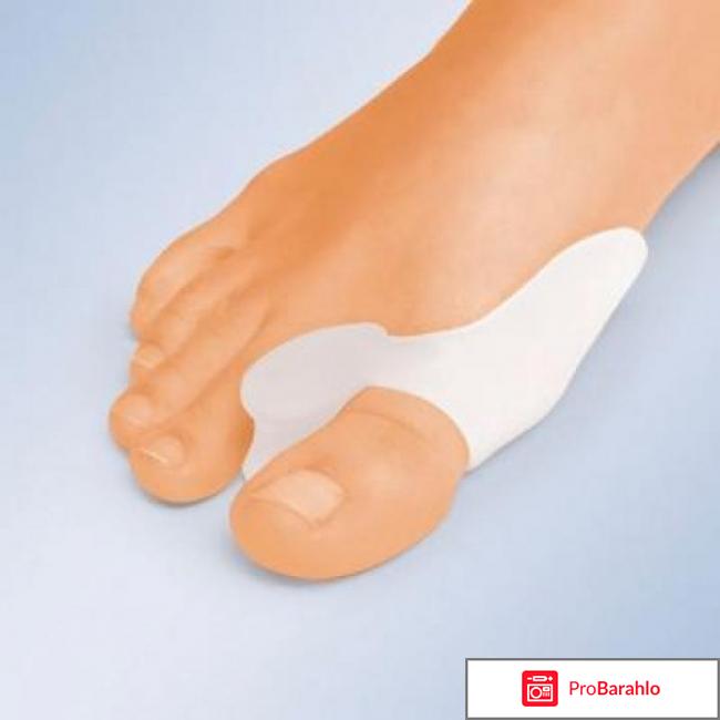 Вальгус про фиксатор для большого пальца отзывы 