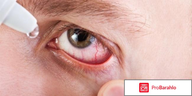 Калий йодид глазные капли инструкция цена отрицательные отзывы