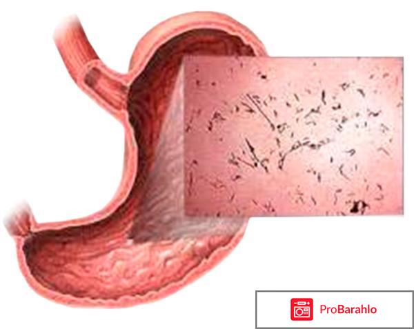 Дизентерия обман