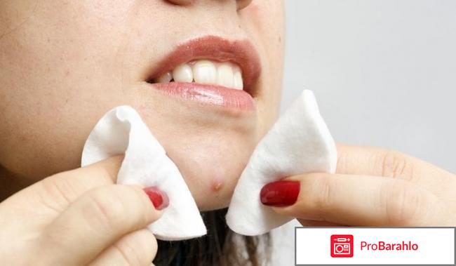 Иодинол на лицо отрицательные отзывы