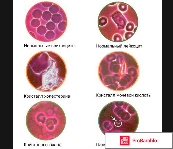 Гемосканирование крови отрицательные отзывы