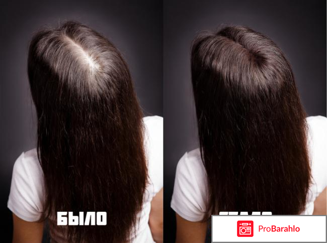 Royal hair (Роял Хэир) отрицательные отзывы