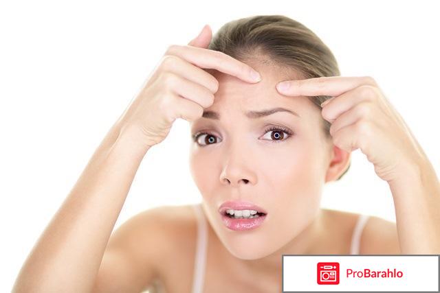 Угревая сыпь на лбу причины и лечение 