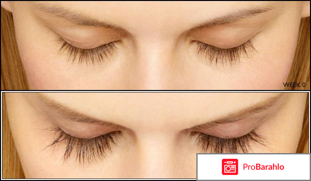 Карепроста отзывы отрицательные отзывы