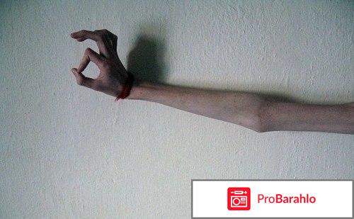 Красная нить на запястье анорексия отрицательные отзывы