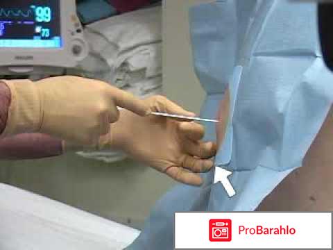 Юрий бурлан отрицательные отзывы 