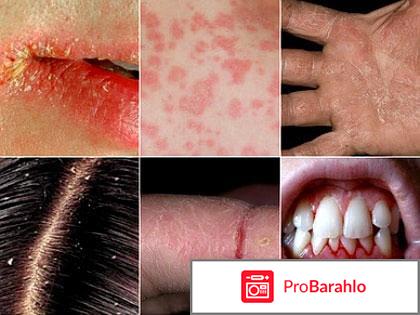 Борьба с авитаминозом в холодное время года отрицательные отзывы