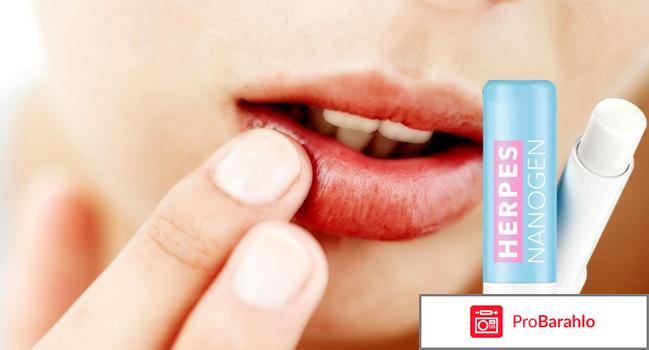 Herpes Nanogen (Герпес Наноген) помада от герпеса 