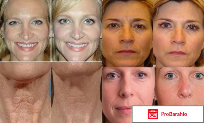 Maxclinic lifting stick реальные отзывы