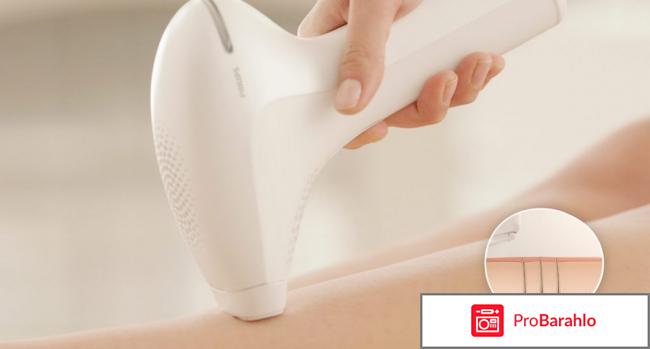 Фотоэпилятор philips lumea отзывы обман