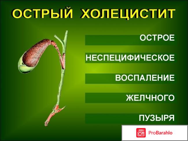 Холецистит 