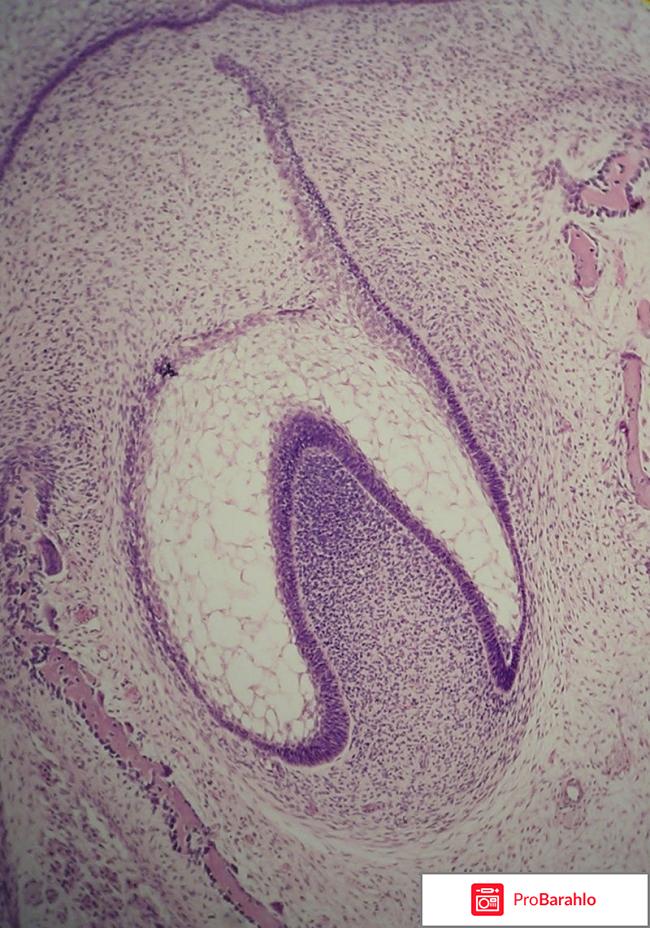 Юнидент обман