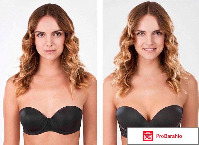 Отзывы после маммопластики 