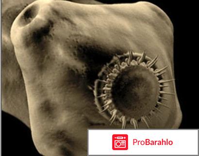 Свиной цепень вызывает заболевание отрицательные отзывы