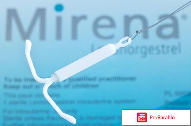 Мирена отзывы врачей 