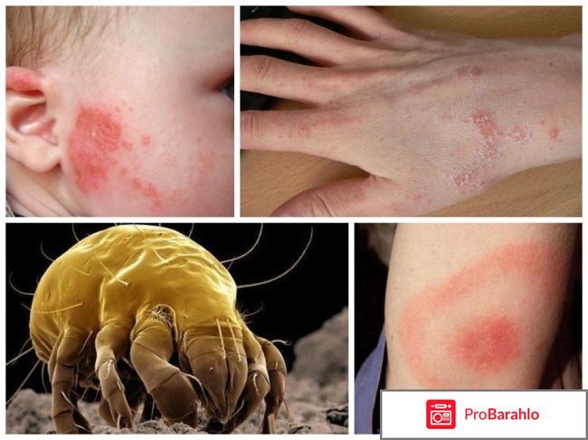 Клещи в постели 