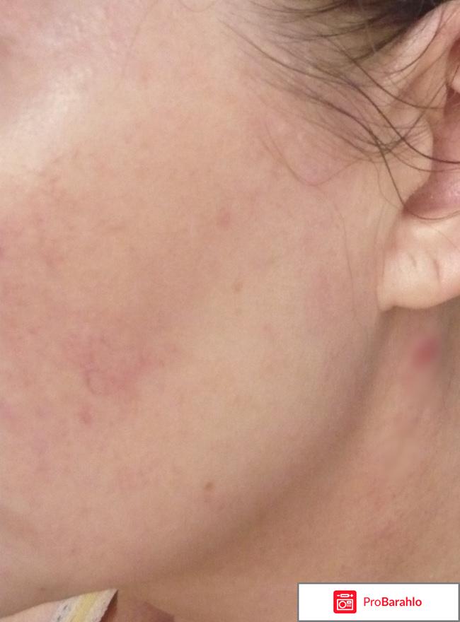 Пантенол крем EVO фото