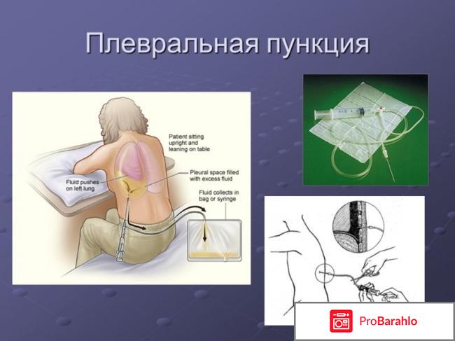 Лосев станислав иванович отрицательные отзывы отрицательные отзывы