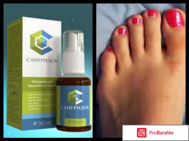 Сангридок реальные отзывы цена обман