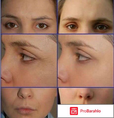 Массажные банки для лица отзывы отрицательные отзывы