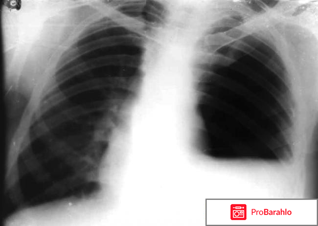 Чахоян левон робертович негативные отзывы обман