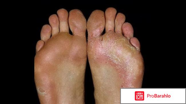 Tinedol (Тинедол) фото