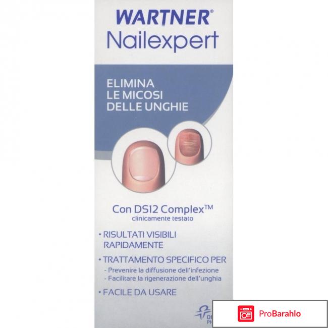 Wartner nailexpert 