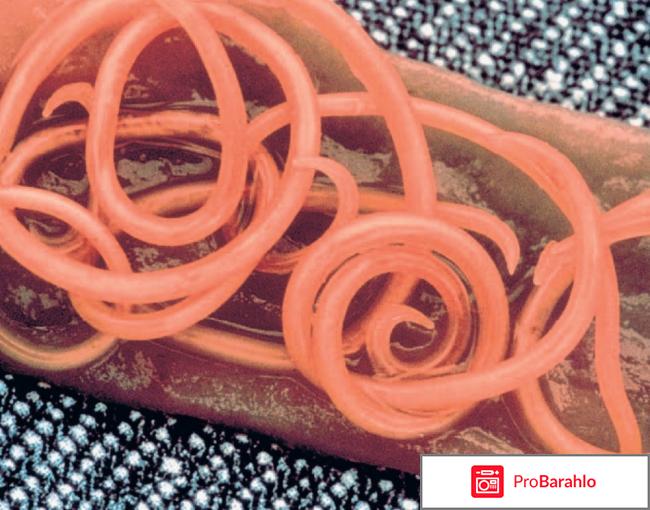 Bactefort развод реальные отзывы