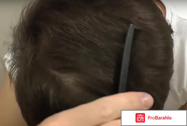 Миноксидил 5 обман