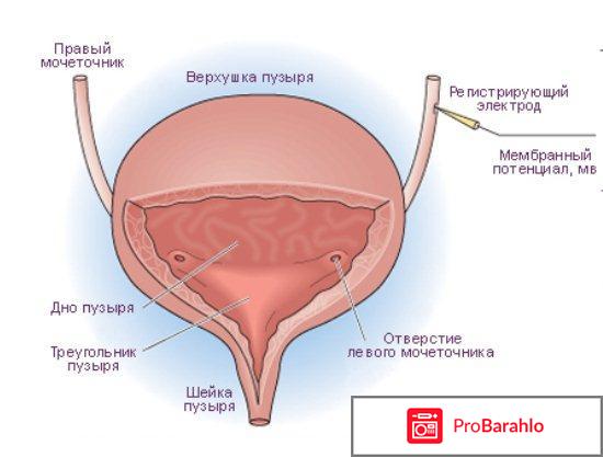 Тур мочевого пузыря отзывы обман